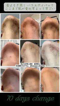 若よもぎ蒸し⭐︎集中ケアコース