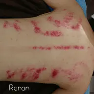 【オプション🚩】フェイシャル、ボディエステと一緒に💕【背中デトックスかっさ】マッサージ付き