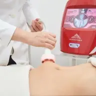 ボディスリミング【ウルトラスリミングコース】(上半身or下半身)