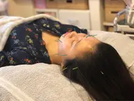 鍼5本追加(初回)