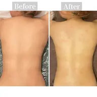 【肩こり・生理痛・足の浮腫み】オイルマッサージ🌿(18~29歳限定)