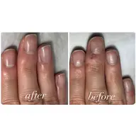 自爪育成(ジェルなし)単品