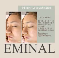 フェイシャルWax脱毛艶肌美容液仕上げ付き