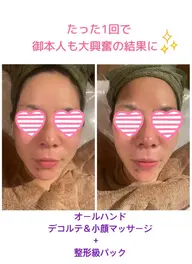 【フェイシャル】整形級✨1回で感動の結果🥹✨小顔マッサージ✖️MTメタトロン✖️母細胞を鍛える炭酸ガスパック　75分