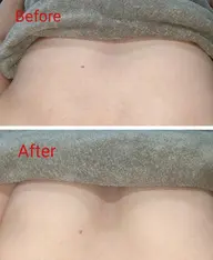 上半身集中(バストケア)