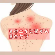 仮予約お得🉐🌸🌈背中ニキビ黒ずみ解消!ハーブピーリングで美白ケア