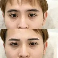 【メンズ】アイブロウワックス脱毛