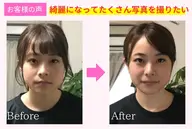 小顔矯正【たるみ改善・法令線・エラ・左右差】頭蓋骨から根本的に整える整体