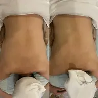 背中スッキリコース