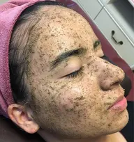 エルモサハーブトリートメント顔 2g  通常22000円→ミニモ価格11000円