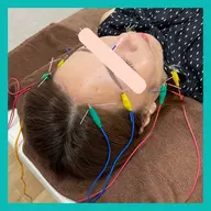 【普通の美容鍼じゃ物足りない方向け】💎プレミアム電気美容鍼💎50本以上🪡鍼多め🦋即効性・持続性抜群✨