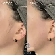 全顔フェイシャルワックス+保湿付き