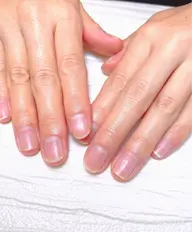 自爪育成ケア1回お試し