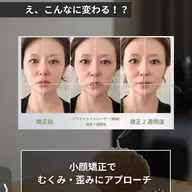 凄腕整体師直伝【小顔矯正】💆🏻♀️💆🏻フェイスラインをキュッと!たるみや歪みには骨格や筋肉へのアプローチを👐