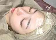 水素毛穴洗浄＋光フォト＋お悩み別選べるパック✨