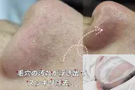 【3月限定】\毛穴黒ずみ＆開き／毛穴洗浄＋保湿パック［小顔首肩リンパ付］50分