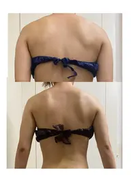 🪽背中美人になりたい方必見🪽【5980円→2980円】🔥上半吸引マシーン＋肩甲骨はがし👐