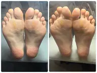 フットワンカラー【オフ込み】+角質ケア※現金払いのみ