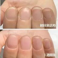 自爪育成ネイルケア&クリアジェルネイル(2回分)