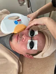 ♢﻿メンズ♢﻿顔脱毛(ヒゲ脱毛)＋光フォト【初回限定価格】