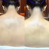 〈 撮影・口コミ投稿 OKな方限定〉レディースシェービング【襟足・背中】