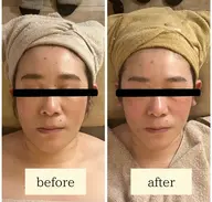 【お顔の悩み解消】コルギフェイシャル（モデリングマスク付き）70分