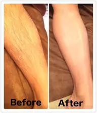 ●脱毛メンズ●【ふくらはぎ＋ひざ下～足首上まで】ワックス脱毛20350⇒¥10450