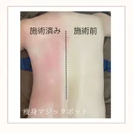 【本気で痩せたい方☆】温活×痩身🔥よもぎ蒸し30分＋マジックポット全身120分