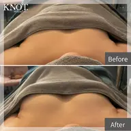 【新規限定】バストUP♡ふっくらツヤツヤの自信のデコルテ・バストラインに👙最新機器NR・プリンセスバスト♡スタンダード