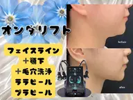 オンダリフト25分|フェイスライン顎下80kj~140kj+鼻の毛穴洗浄+ララピールorプラピール