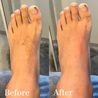 【男性】1部位（小パーツ）・眉毛だけ・指（手or足）・甲（手or足） ・乳首周り・鼻毛