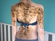 背中上下ハーブピーリング(剥離なし)+鎮静