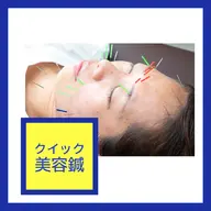 パッと受けてお顔シュッと【クイック電気美容鍼】初回お試し/鍼はじめてさん向け/むくみでパンパンの顔すっきり