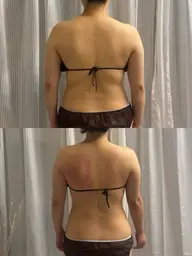 全身痩身 cavi × RF ×vacuum × EMS ×heatmat 150min 【表参道限定】