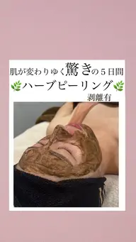 【剥離有】🌿100%天然ハーブピーリング🌿陶器肌✨️ニキビ・ニキビ肌撃退！毛穴＆黒ずみ＆くすみケア✨️✨️