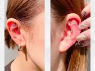 大人気⭐️耳ツボジュエリー10粒⭐️ 限定価格‼️