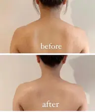 おすすめ［BODY]🦋キャピ瘦身🦋超音波＆EMS美白🦋✨60分¥ 3980