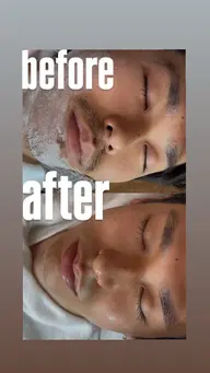 メンズ顔シェービング