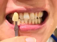 【ご新規】時短！10分照射2回セットセルフホワイトニング