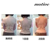 【minimo限定】motive痩身ジェルくびれ体験✨️(口コミ お写真の撮影 SNS掲載 お願いします🙂‍↕️)