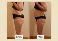 【人気No.1】最先端よもぎ蒸し＋痩身小顔美肌ケア90分¥13,800→¥7,800