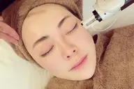 【✨1日1名様限定✨】最強小顔SET＋無針リジュラン導入で韓国美顔を手に入れよう‼️