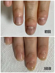 爪育成(ホームケア付き)※ジェル・アクリル育成