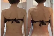 背中​〜​二の腕部分の痩身✨