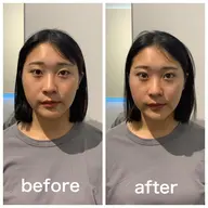 【変化実感No.1】エラ張り/顎の歪み＋小顔矯正/姿勢矯正【50分17900→2900】