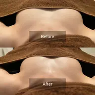 1日3名様限定❗️人気No. 1🌟\理想のバストになりたい方/ボリュームUP・ハリ・弾力・下垂・左右差改善!!