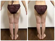 ミニモ学割✨下半身が痩せにくい方のウィンバック足痩せ痩身コース✨セルライトが気になる方に‼️お気に入りに登録者限定♪