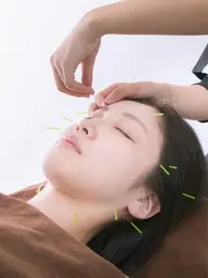 No. 1人気メニュー!🌸基本美容鍼+首肩頭マッサージ🌸 75分