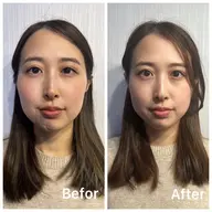 《何度も使える》左右差/歪みに◎独自メソッドの小顔矯正¥15000