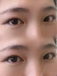 ラッシュリフト